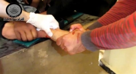 έτσι κόβουν τα χέρια στη Συρία. Από το επίμαχο βίντεο